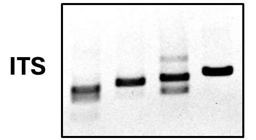 Quality DNA from crap samples – The importance of DNA quality in metabarcoding